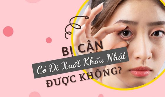 Bị Cận Có Đi Xuất Khẩu Nhật Được Không?